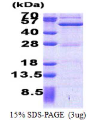 SDS-PAGE: Recombinant Human ASCC1 His Protein [NBP2-22636]