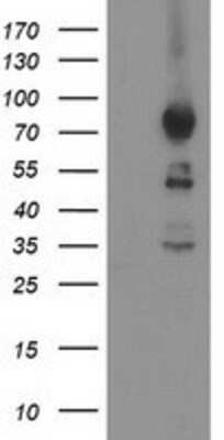 Western Blot: ASCC2 Antibody (OTI1E8) [NBP2-00675]