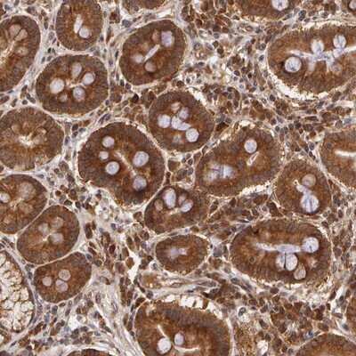 Immunohistochemistry-Paraffin: ASCC2 Antibody [NBP1-88815]