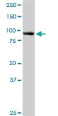 Western Blot: ASCC2 Antibody [H00084164-B01P]