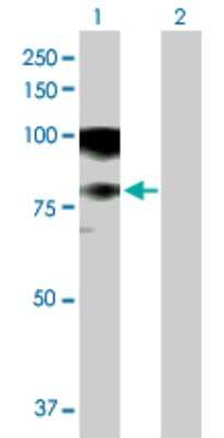 Western Blot: ASCC2 Antibody [H00084164-B01P]