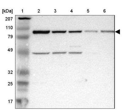 Western Blot: ASCC2 Antibody [NBP1-88815]