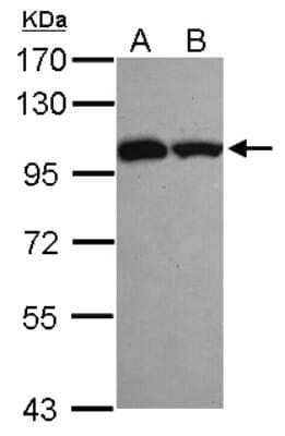 Western Blot: ASCC2 Antibody [NBP2-15487]