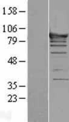 Western Blot: ASCC2 Overexpression Lysate [NBL1-07758]