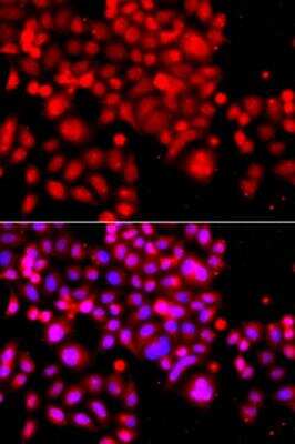 Immunocytochemistry/ Immunofluorescence: ASCC3 Antibody - BSA Free [NBP2-92682]