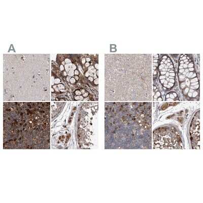 Immunohistochemistry-Paraffin: ASCC3 Antibody [NBP1-88829]