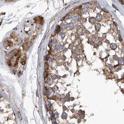 Immunohistochemistry-Paraffin: ASCC3 Antibody [NBP1-88853]