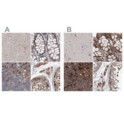 Immunohistochemistry-Paraffin: ASCC3 Antibody [NBP1-88854]