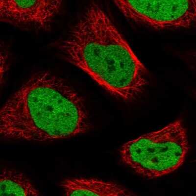 Immunocytochemistry/ Immunofluorescence: ASCC3L1 Antibody [NBP1-90086]