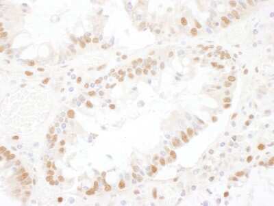 Immunohistochemistry-Paraffin: ASCC3L1 Antibody [NBP1-79037]