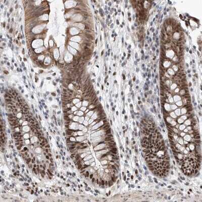 Immunohistochemistry-Paraffin: ASCC3L1 Antibody [NBP1-90086]