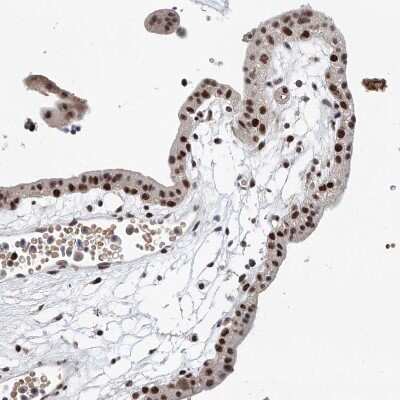 Immunohistochemistry-Paraffin: ASCC3L1 Antibody [NBP1-90086]