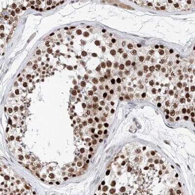 Immunohistochemistry-Paraffin: ASCC3L1 Antibody [NBP1-90086]