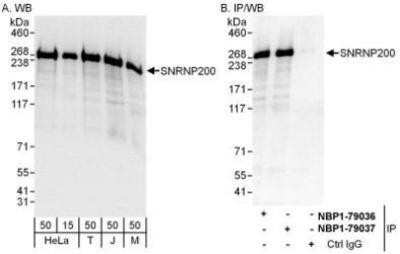 Western Blot: ASCC3L1 Antibody [NBP1-79036]