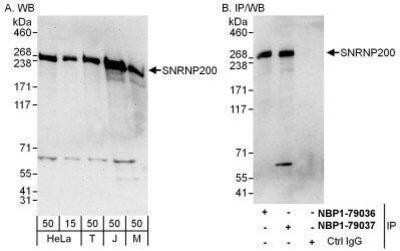 Western Blot: ASCC3L1 Antibody [NBP1-79037]