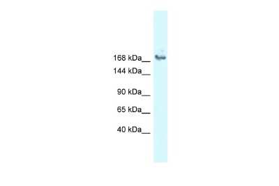 Western Blot: ASCC3L1 Antibody [NBP2-87044]