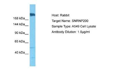 Western Blot: ASCC3L1 Antibody [NBP2-87044]