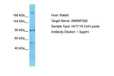 Western Blot: ASCC3L1 Antibody [NBP2-87044]