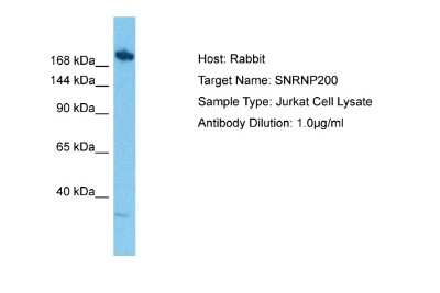 Western Blot: ASCC3L1 Antibody [NBP2-87044]