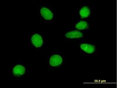 Immunocytochemistry/ Immunofluorescence: ASCIZ Antibody [H00023300-B01P]