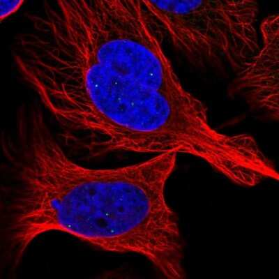 Immunocytochemistry/ Immunofluorescence: ASCIZ Antibody [NBP2-58746]