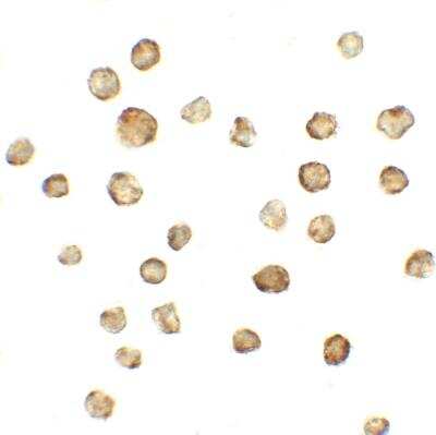 Immunocytochemistry/ Immunofluorescence: ASCIZ Antibody - BSA Free [NBP2-81796]