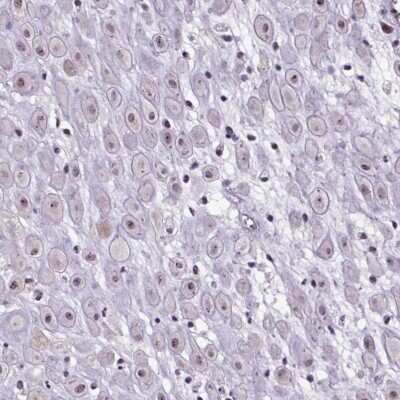 Immunohistochemistry-Paraffin: ASCIZ Antibody [NBP2-39079]