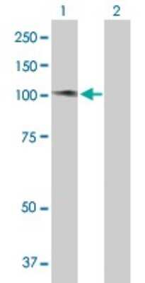 Western Blot: ASCIZ Antibody [H00023300-B01P]