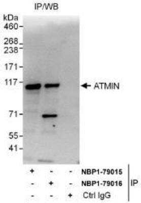 Western Blot: ASCIZ Antibody [NBP1-79015]