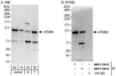 Western Blot: ASCIZ Antibody [NBP1-79016]