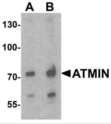 Western Blot: ASCIZ AntibodyBSA Free [NBP2-81796]