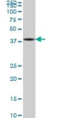 Western Blot: ASCL1/Mash1 Antibody (1C5) [H00000429-M04]