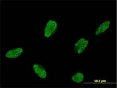 Immunocytochemistry/ Immunofluorescence: ASCL1/Mash1 Antibody (2D9) [H00000429-M02]