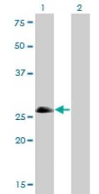 Western Blot: ASCL1/Mash1 Antibody (7E11) [H00000429-M01]