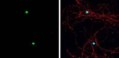 Immunocytochemistry/ Immunofluorescence: ASCL1/Mash1 Antibody [NBP3-13159]