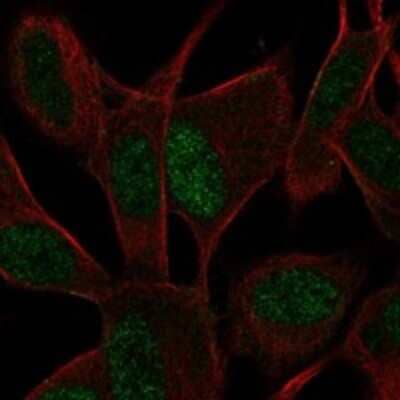 Immunocytochemistry/ Immunofluorescence: ASCL1/Mash1 Antibody [NBP3-17687]