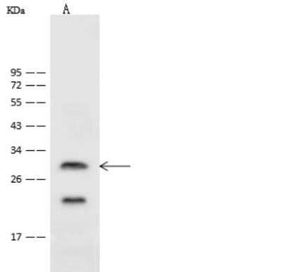 Western Blot: ASCL1/Mash1 Antibody [NBP2-99418]