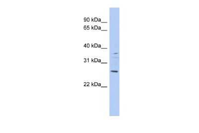 Western Blot: ASCL2/Mash2 Antibody [NBP2-83940]