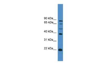 Western Blot: ASCL2/Mash2 Antibody [NBP2-83941]