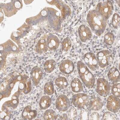 Immunohistochemistry-Paraffin: ASCL3 Antibody [NBP1-88635]