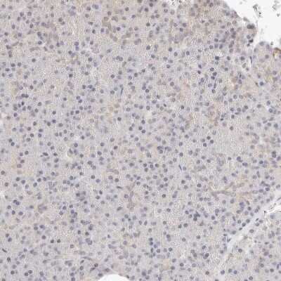 Immunohistochemistry-Paraffin: ASCL3 Antibody [NBP1-88635]