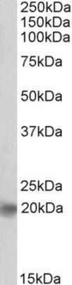 Western Blot: ASCL3 Antibody [NBP1-68871]