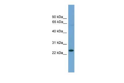 Western Blot: ASCL3 Antibody [NBP3-10429]