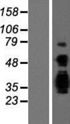 Western Blot: ASCL3 Overexpression Lysate [NBP2-06627]