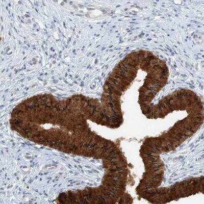 Immunohistochemistry: ASCL4 Antibody [NBP1-90762]