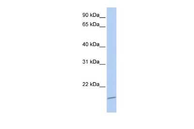 Western Blot: ASCL4 Antibody [NBP2-82685]