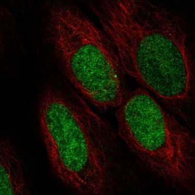 Immunocytochemistry/ Immunofluorescence: ASF1a Antibody [NBP2-57504]