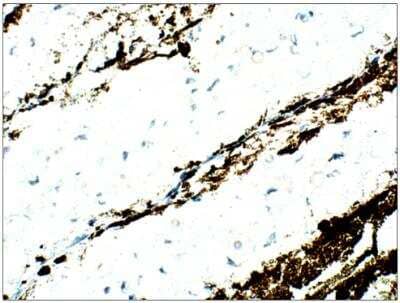 Immunohistochemistry-Paraffin: ASF1a Antibody [NBP3-12189]