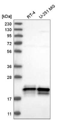 Western Blot: ASF1a Antibody [NBP2-57608]