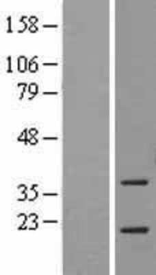 Western Blot: ASF1a Overexpression Lysate [NBL1-07760]